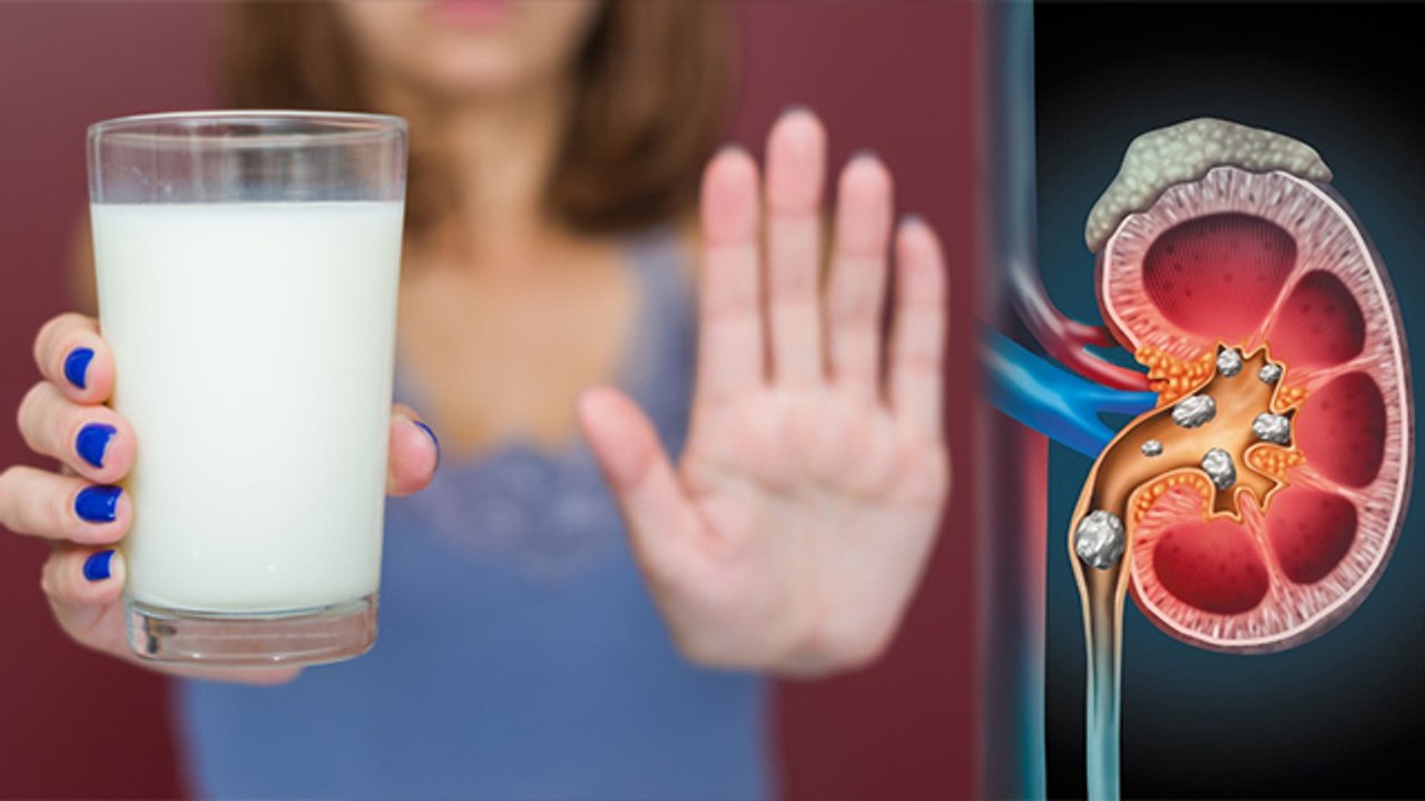 पथरी में दूध पीना चाहिए या नहीं  | Kidney Stone me Milk peene se kya hota hai | Boldsky *health