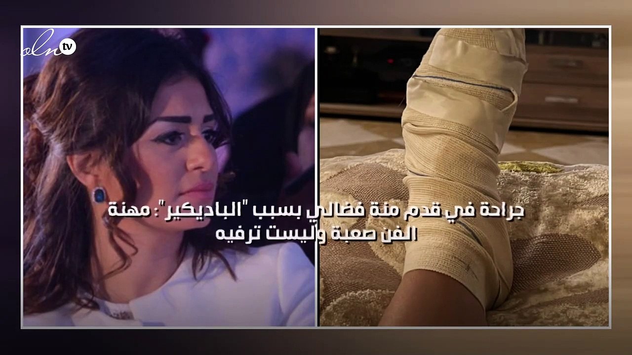 جراحة في قدم منة فضالي بسبب "الباديكير": مهنة الفن صعبة وليست ترفيه