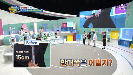 바로 나타나는 효과! 귀 지압 후 어깨 상태는 어떻게 달라졌을까?