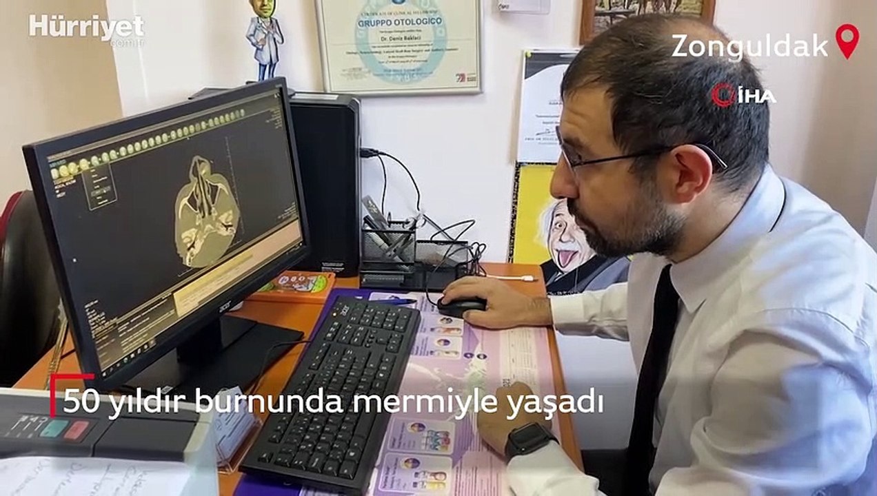 Yüzünde 50 yıldır taşıdığı kurşun ameliyatla alındı