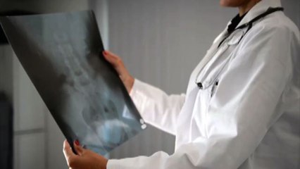 Rimborsabile nuovo farmaco per spondilite anchilosante, ok Aifa