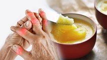 Arthritis में घी के चौंकाने वाले फ़ायदे | गठिया रोग में घी खाने से क्या होगा ? | Boldsky *health