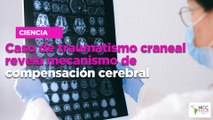 Caso de traumatismo craneal revela mecanismo de compensación cerebral