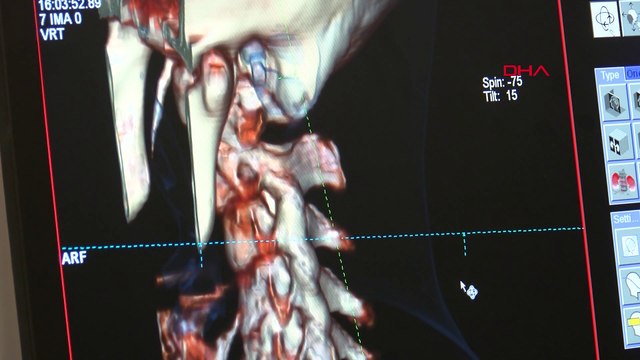 Aşırı cep telefonu kullananlarda 'Whatsappit' riski