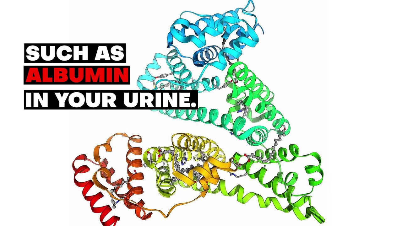 Is it NORMAL to have a FOAMY URINE Cause and Treatment video Dailymotion