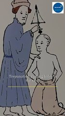 Trepanation, medical treatment or ritual to let demon out from the skull