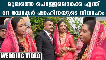 മുഖത്ത് പൊള്ളലേറ്റ ഡോ ഷാഹിനയുടെ വിവാഹം, മൊഞ്ചൻ കല്യാണചെക്കനെ കണ്ടോ
