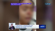 5 residente, inatake ng aso; batang isa sa mga biktima, kinagat sa ilong | Saksi