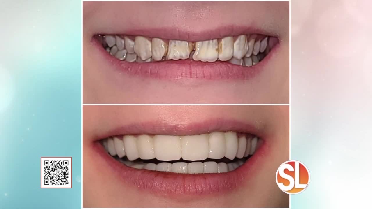 Dental Specialty Associates (DSA) provides quality dental care including implants, dentures, IV sedation and cosmetic