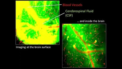 TED Talk - One more reason to get a good night’s sleep