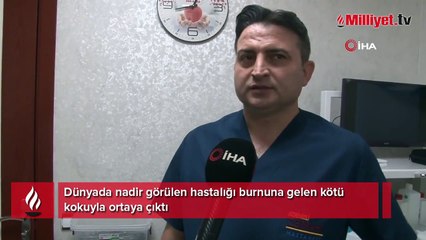 Burnuna gelen kötü koku gerçeği ortaya çıkardı! 30 yıldır kitleyle yaşamış