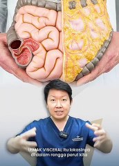 CARA MENGHILANGKAN PERUT BUNCIT