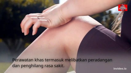 Nyeri sendi kenali pemicu dan penyebabnya