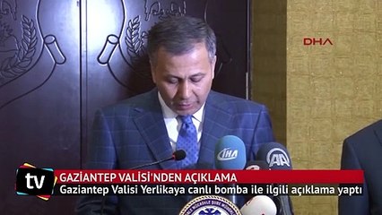 Canlı bombanın hedefi açıkladı: Ak Parti Kongresi