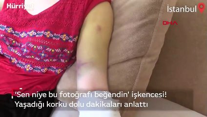 Fotoğrafı beğendiği için eşi tarafından darp edildi!