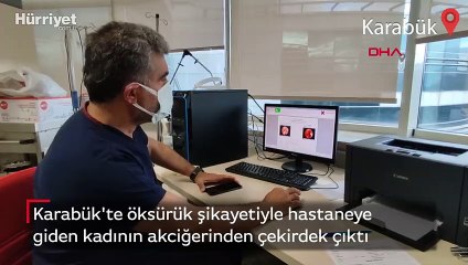 Karabük'te öksürük şikayetiyle hastaneye giden kadının akciğerinden çekirdek çıktı