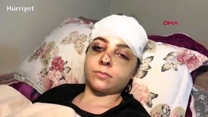 Sultangazi'de tayt dayağı: karısını hastanelik etti, serbest kaldı