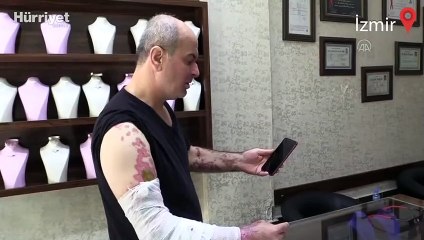 İş yerinin önünde kezzaplı saldırıya uğrayan kuyumcu sol gözünü kaybetti