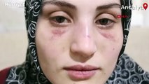 Eşinden şiddet gören genç kadın, yaşadığı işkence anlarını anlattı