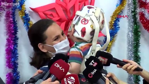 İngiltere'de operasyonla ayrılan siyam ikizleri 3 yaşında