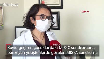 Kovid geçiren çocuklardaki MIS-C sendromuna benzeyen yetişkinlerde görülen MIS-A sendromu 
