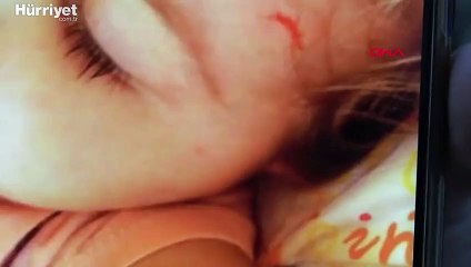 Kreşteki şiddeti oyuncağın içine koyulan ses kayıt cihazı ortaya çıkardı