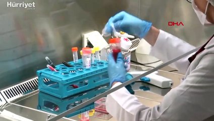 Cerrahpaşa'da araştırılıyor: Koronavirüs geçirenlerin yüzde 30'unun saçı döküldü