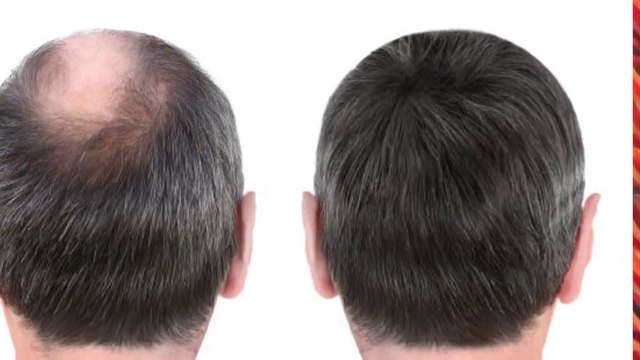 foods for hair growth