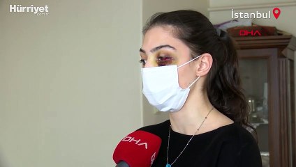 Telefonda video izlediği için kocasından şiddet gördü