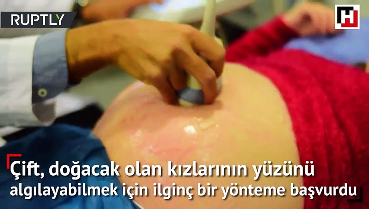 Görme engelli çift bebeklerini böyle “gördü”