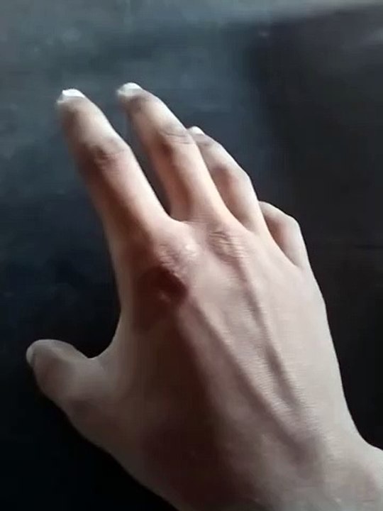 My hands
