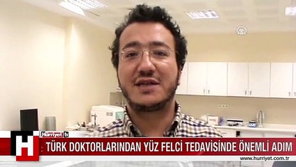 YÜZ FELCİ HASTALARINA MÜJDE