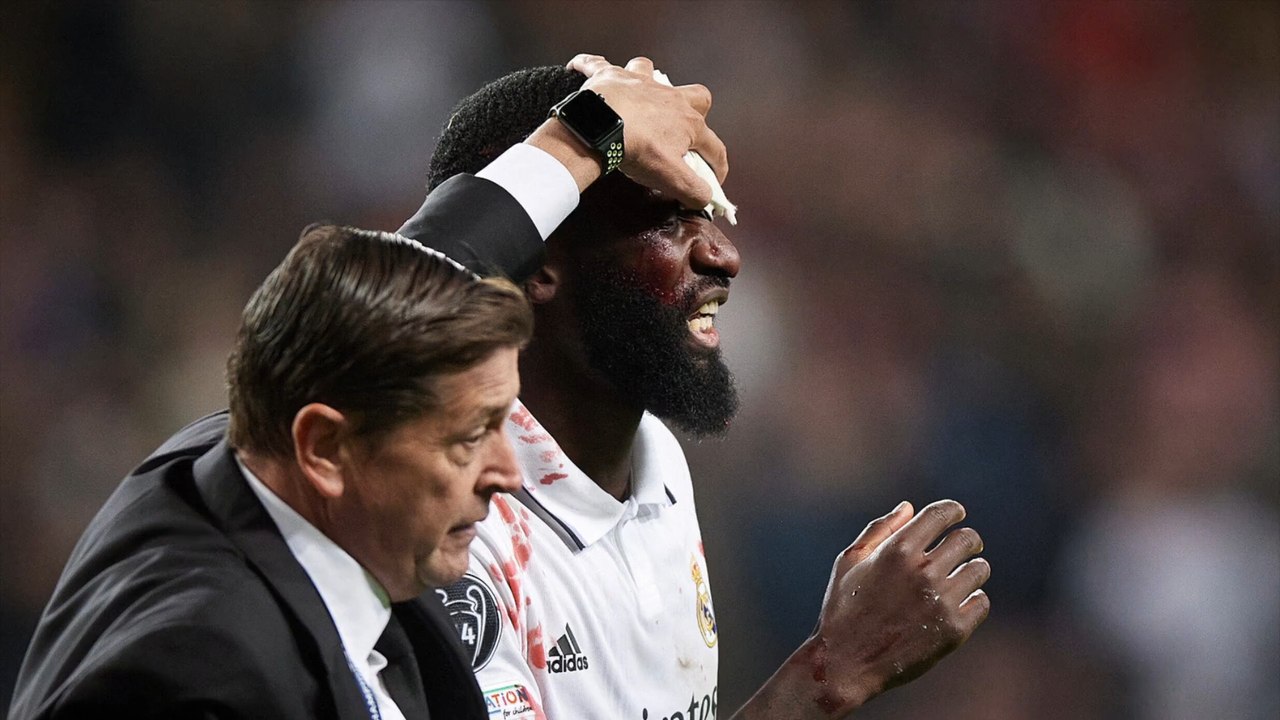 Real-held rüdiger kann zugeschwollenes auge nicht öffnen