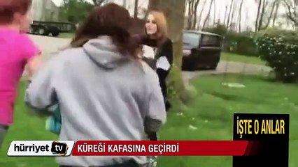 Genç kızın kafasına küreği geçirdi