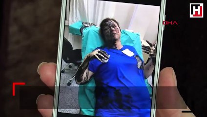 Üzerine siyah sıvı dökülen iş kadını konuştu