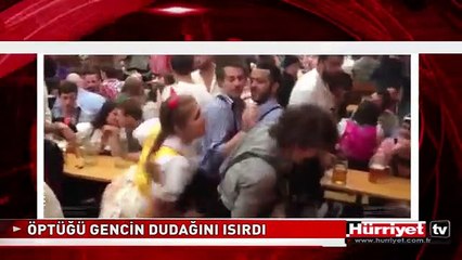 KAVGA ETTİĞİ ADAMIN DUDAĞINI BÖYLE ISIRDI