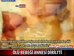 MUCİZE OLDU ÖLÜ BEBEK DİRİLDİ