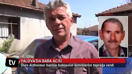 Torbada Alzheimer hastası babasının kemikleri var