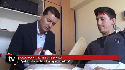 Ayak parmakları eline dikildi