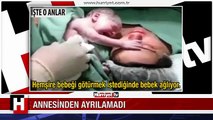 YENİ DOĞMUŞ BEBEK ANNESİNİ BIRAKAMADI