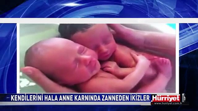 KENDİLERİNİ HALA ANNE KARNINDA ZANNEDEN İKİZLER