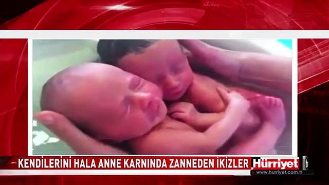 KENDİLERİNİ HALA ANNE KARNINDA ZANNEDEN İKİZLER
