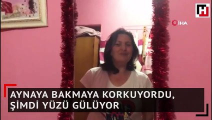 Aynaya bakmaya korkuyordu, şimdi yüzü gülüyor