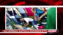 GAZ BOMBASI KAPSÜLÜ İSABET EDEN GENÇ GÖZÜNÜ KAYBETTİ! TAKSİM GEZİ PARKI OLAYLARI