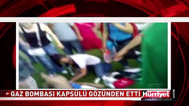 GAZ BOMBASI KAPSÜLÜ İSABET EDEN GENÇ GÖZÜNÜ KAYBETTİ! TAKSİM GEZİ PARKI OLAYLARI