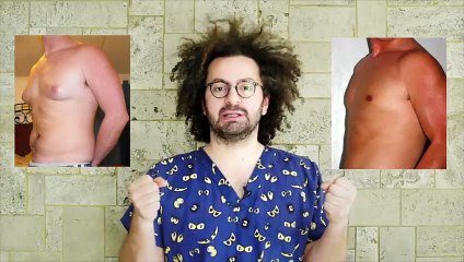 Erkekler arasında yaygın olan 5 popüler estetik uygulaması | Doktor Bu Ne?