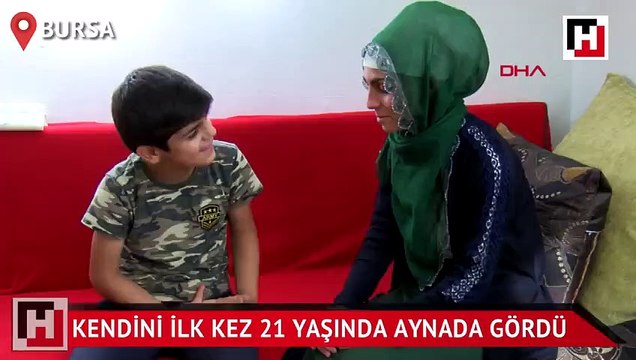 Kendini ilk kez 21 yaşında aynada gördü