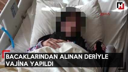 Bacaklarından alınan deriyle vajina yapıldı