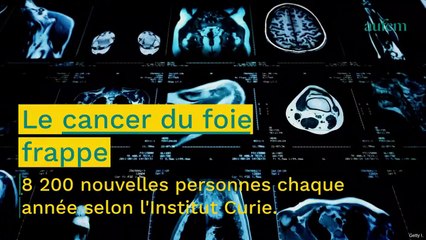 Cancer du foie : cette boisson doit impérativement être évitée pour réduire les risques chez la femme