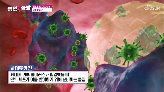 만성피로와 만병의 원인이 되는 내 몸속 염증 TV CHOSUN 20221014 방송
